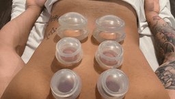 Image for Cupping Massage